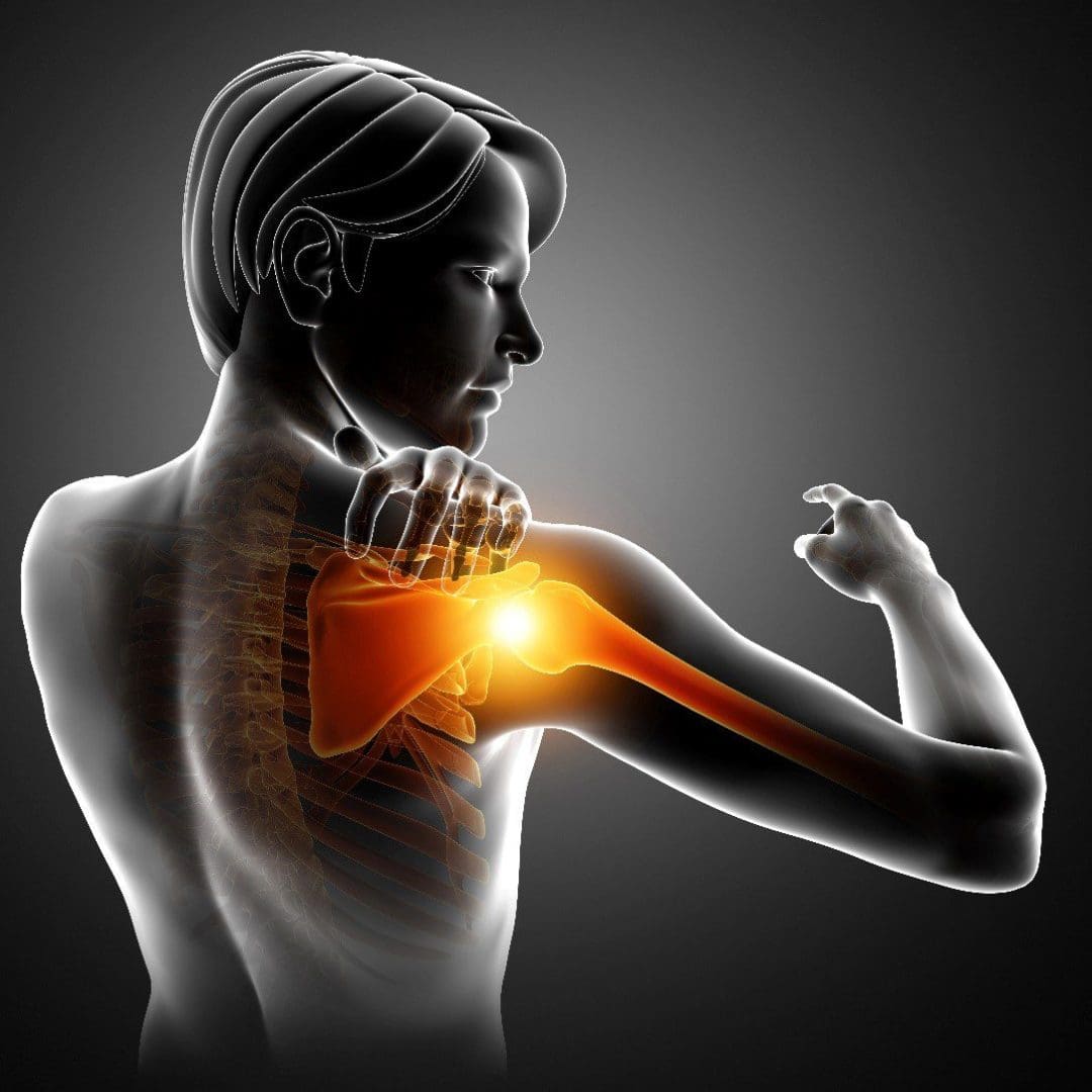 AC (Acromioclavicular) Joint Injury and Pain