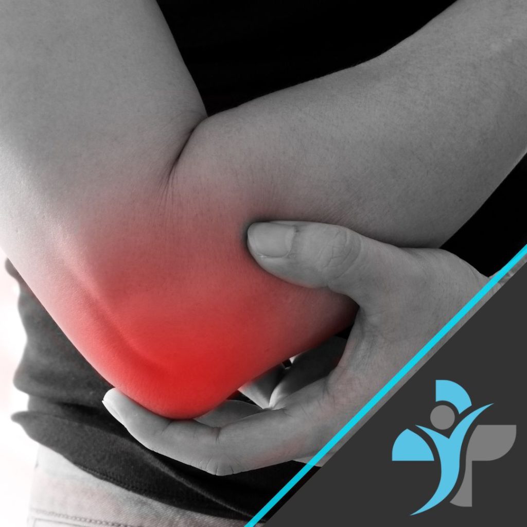 Tennis Elbow Main Image for article