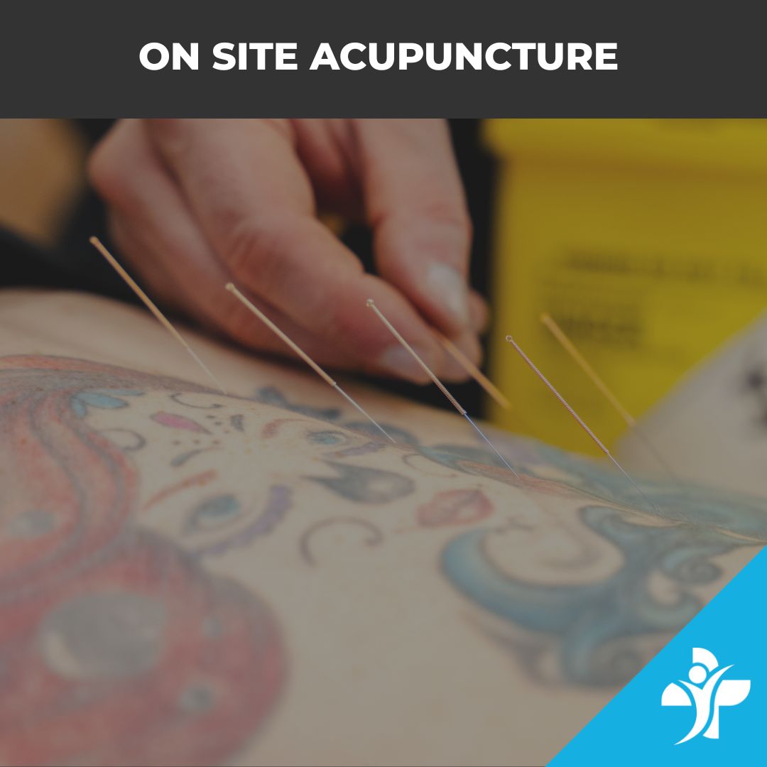 Corporate Acupuncture Image