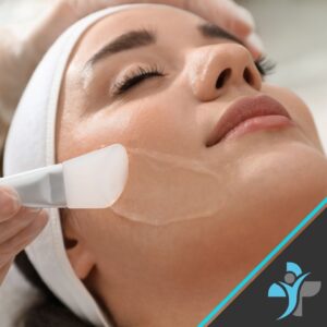Chemical Peels