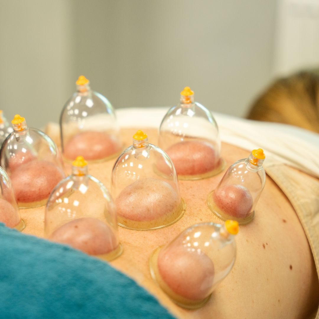 Cupping Services by LiveWell Cupping Services by LiveWell